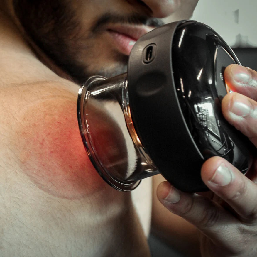 RelaxPro Cupping – Ontspan, Herstel en Verlicht Pijn Snel