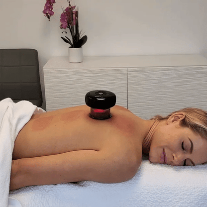 RelaxPro Cupping – Ontspan, Herstel en Verlicht Pijn Snel