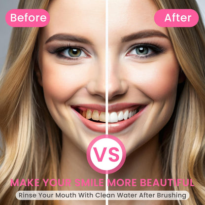 Niacinamide Witte Tanden Boost Dagelijks