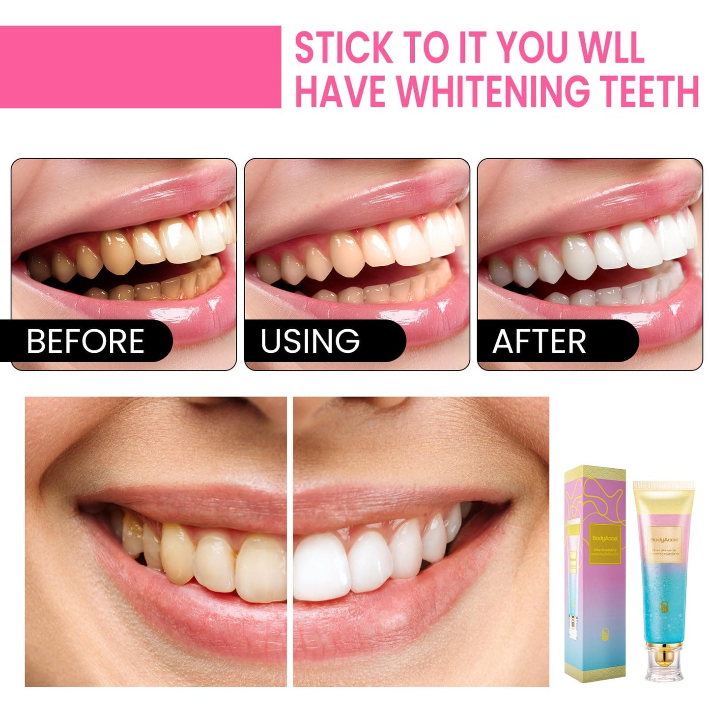 Niacinamide Witte Tanden Boost Dagelijks